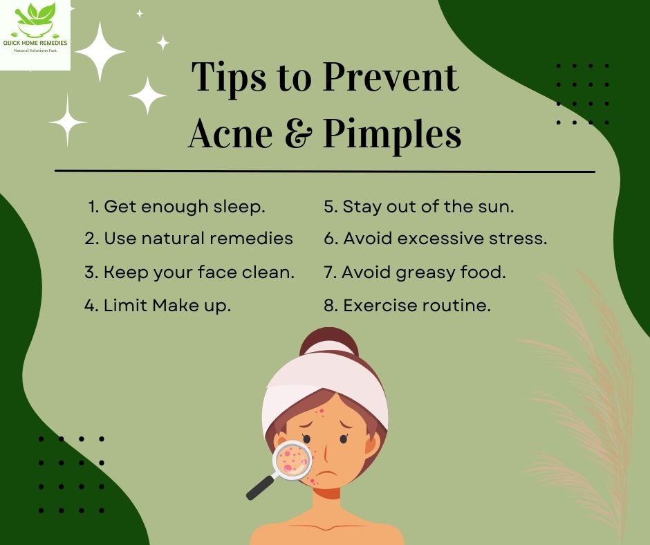 Quick Home Remedies for Pimples
