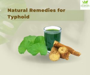 Natural Remedies for Typhoid
